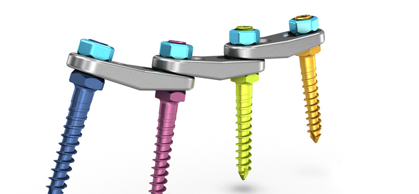 Pedicular osteosynthesis 06 picture